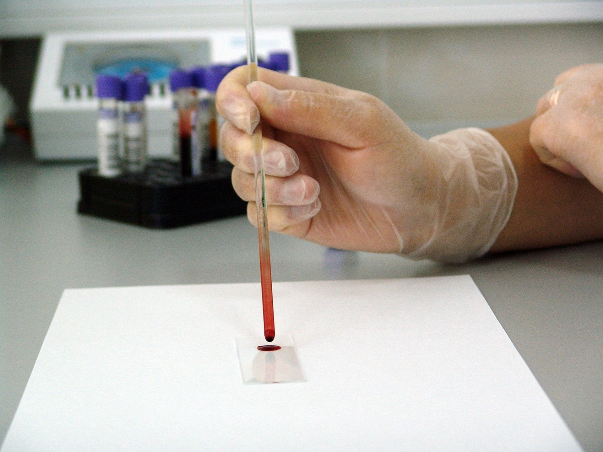 From Hofmann to today: milestones in psilocybin research timeline